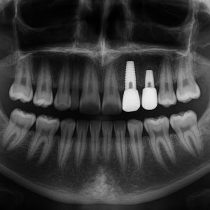 Prvky 4. skupiny - titán, zirkónium, hafnium