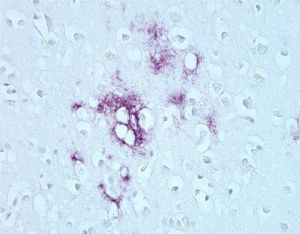 Nebunkové organizmy