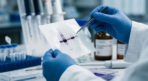 Imunodetekcia proteínov - western blotting