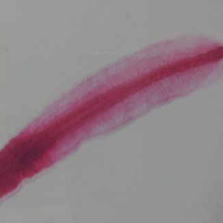 Štrbinovka široká (scolex)