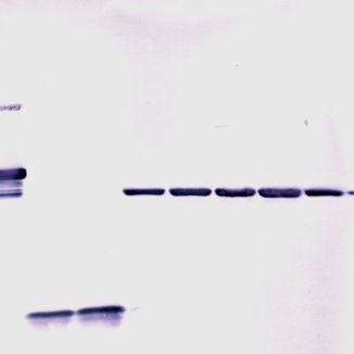 Fotografia ukazuje výsledok western blot analýzy
